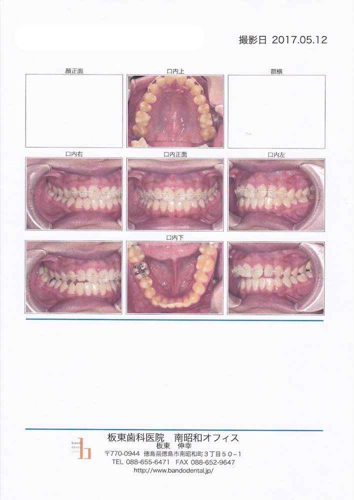 歯周診断書